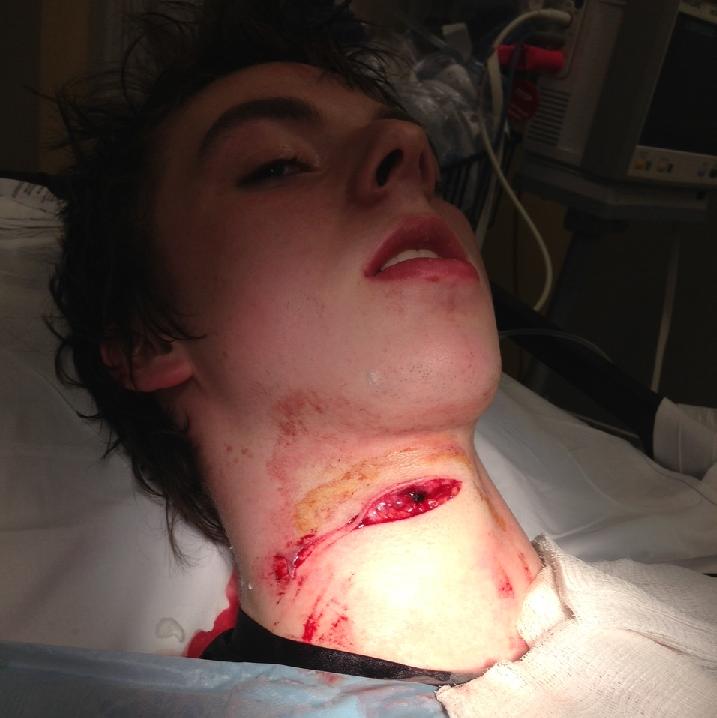 Hockey Player Cuts Throat 16